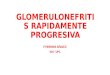 Glomerulonefritis rapidamente progresiva