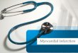 Myocardial  infarction