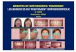 Benefits of orthodontic treatment les benefices du traitement orthodontique- o sandid- pdf