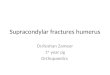 Supracondylar fractures humerus