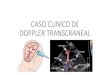 Caso clínico doppler transcraneal