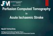 Nguyen trường giang perfusion computed tomography in acute ischaemic stroke jfim hanoi 2015