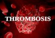 Thrombosis & Haemostasis: Research