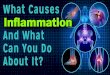 Chronic Inflammation and its Effects on Your Body
