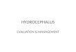 Hydrocephalus diagnosis and management