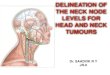 Head n neck nodal delineation ppt