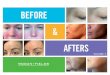 Rodan + Fields Before And After Photos 2015