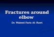 Fractures around elbow
