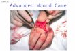 Advanced Wound Care  