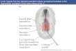 14.20 Signals from the paraxial mesoderm induce pronephros formation in the intermediate mesoderm of