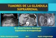 Tumores de la glandula suprarrenal diagnóstico imagenológico