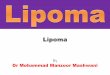 Lipoma by manzoor