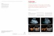 Clinical examples of the use of contrast-enhanced ultrasound (CUES) as a routine gastroenterological diagnostic tool
