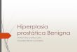 Hiperplasia prostática benigna2