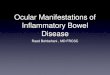 Ocular Manifestations of Inflammatory Bowel Disease