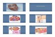 Renal Disease - Indiana University School of  · PDF file1 Renal Disease Basic Anatomy Renal MicroanatomyRenal Microanatomy Glomerular Microanatomy The Business End of the Kidney