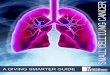SMALLCELL LUNG%CANCER - -  · PDF fileThere are two major types of lung cancer: non-small cell lung cancer (NSCLC) and small cell lung cancer (SCLC)
