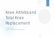 Knee Arthritis and Total Knee Replacement - Johnston …johnstonhealth.org/.../Knee-Arthritis-and-Total-Knee-Replacement.pdf · Symptoms include pain, ... Total Knee Arthroplasty