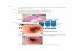 Esophagus - Dr. Alexander Mantas · PDF fileEsophagus A&P ... (SAP): fancy calculation ... CNS Dz (CVA of brainstem/cerebellum or bilateral hemispheres, if stroke related dysphagia
