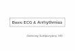 Basic ECG & Arrhythmias - Thai  · PDF fileCardiac Cycle R S P T T PR Q S QT interval P wave: Atrial contraction (