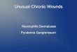 Neutrophilic Dermatoses Pyoderma Gangrenosum · PDF filePyoderma Gangrenosum Pyo- prefix for pus Derma- another term for dermis, alternatively skin or disease of the skin Gangrenosum-