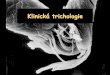Klinická trichologie - is.muni.cz · PDF filehormonální poruchy (hypo i hypertyreoidismus) ... sklerodermie, folliculitis decalvans) neznámá etiogeneze (pseudopelade, folliculitis