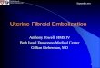 Uterine Fibroid Embolization - Lieberman's · PDF file3 Anthony Powell Gillian Lieberman, MD Uterine Fibroids zLeiomyoma- benign proliferation of uterine smooth muscle cells zHormonally