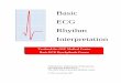 Basic ECG Rhythm Interpretation - rn.com Basic ECG Rhythm Interpretation Objectives At the completion of this course the learner will be able to: 1. Identify the sequence of normal