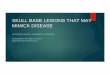 SKULL BASE LESIONS THAT MAY MIMICK DISEASE - … Lifelong Learning/Meetings/ASM2016... · Background Imaging of the skull base can be a daunting task even for experienced radiologists