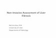 Non-Invasive Assessment of Liver Fibrosisarup.utah.edu/media/fibrometer/lecture-slides.pdfNon-Invasive Assessment of Liver Fibrosis Patricia Slev, PhD University of Utah . Department
