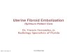 Uterine Fibroid Embolization - Florida Hospital of Uterine Fibroid Embolization (UFE) Confidential Uterine Leiomyoma ... Uterine fibroid embolization versus myomectomy in women wishing