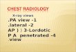 Pleural diseases pleural effusion pneumothorax hydro pneumothorax pleural ... · PPT file · Web view · 2013-11-16Title: Pleural diseases pleural effusion pneumothorax hydro pneumothorax