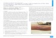 Gulf Journal of Dermatology and Venereology CD30-positive Anaplastic Large Cell Lymphoma of the skin in association with Mycosis fungoides: A case report Talal A Al-Hetmi, BMSs, MD
