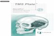 Temporalis Muscle Suspension Plate - Kinamed · PDF filemasticatory dysfunction and cosmetic deformity.1,3,4 The Temporalis Muscle Suspension (TMS) Plate has been designed to allow
