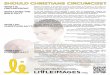 WHAT IS CIRCUMCISION? WHAT DOES THE BIBLE … IS CIRCUMCISION? Modern circumcision is thesurgical removalof the foreskin of the penis.In the USAitis performed on about half of baby