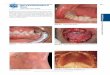 Atlas of Oral Manifestations of - McGraw-Hill Education - …€¦ ·  · 2015-01-31Atlas of Oral Manifestations of Disease Corit 215 Mra-Hill Eation All rits resere ... The health