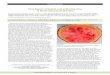 First Report of Squash vein yellowing virus in … HEALTH PROGRESS Vol. 16, No. 3, 2015 Page 113 Plant Health Brief First Report of Squash vein yellowing virus in Watermelon in Guatemala