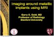Imaging around metallic implants using MRI Around Metal - Gold.pdfImaging around metallic implants using MRI Thursday, ... CT scan with artifacts ... • Pre contrast T1 SE or FSE,