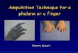 Amputation Technique for a phalanx or a finger€¦ · Amputation Technique for a phalanx or a finger Thierry Dubert. General Principles – Decrease functional sequelae • Fine