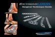 Table of Contents - OsteoMed - Rethinking possibilities, …€¦ ·  · 2017-08-21osteomed.com Page 3 Table of Contents System Overview Indications System Components Implant Tray