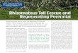 Rhizomatous Tall Fescue and Regenerating Perennialarchive.lib.msu.edu/tic/stnew/article/2012sum16.pdf · Rhizomatous Tall Fescue (RTF) Before we can look at RTF in sports fi elds,