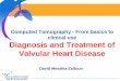 Diagnosis and treatment of valvular heart disease.assets.escardio.org/assets/presentations/EE2012/48.pdfDiagnosis and Treatment of Valvular Heart Disease David Messika-Zeitoun Disclosures