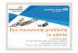 Eye movement problems in adults - Bedfordshire Loc · Eye movement problems in adults ... Non-comitant 1. Cranial nerve problem: ... then strabismus, then lids Steroids,thyroxine,