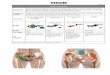 Gluteal Tendinopathy 16.1 - THOR Photomedicine · Gluteal Tendinopathy Keywords ... da Silva EA, Aimbire F, Marcos RL, ... Evaluating the effect of low-level laser therapy on healing
