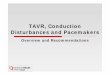 TAVR, Conduction Disturbances and Pacemakerssummitmd.com/pdf/pdf/2040_Meredith.pdf · CoreValve Pacemaker Implantation ... atrioventricular block (Class IIa) C Evidence 4. Symptomatic
