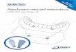 y manual Clinical & Attachment-retained restorations/media/M3 Media/DENTSPLY IMPLANTS/Pro… · Restorative overview 4 ... • Provide an even load on the mucosa when the prosthesis