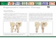 Regenerative Injection Therapy 9 - Prolotherapy Florida Injection... · Regenerative Injection Therapy 9 87 Regenerative injection therapy (RIT), ... costovertebral, and sternochondral