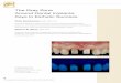 The Gray Zone Around Dental Implants: Keys to Esthetic Successmaryland-agd.org/uploads/3/4/7/4/34747471/gamborena_proof.pdf · THE AMERICAN JOURNAL OF ESTHETIC DENTISTRY The Gray