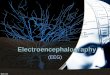 Electroencephalography - :: ภาควิชา ... · Electroencephalography (EEG) ... – Silver/silver chloride (Ag/AgCl), gold, tin, ... • Patients for whom test stimulation