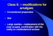 Class II. modifications for amalgam - Masarykova … · Class II. – modifications for amalgam ... Bažant V. Konservační zubní lékařství, ... Large amalgam restoration -